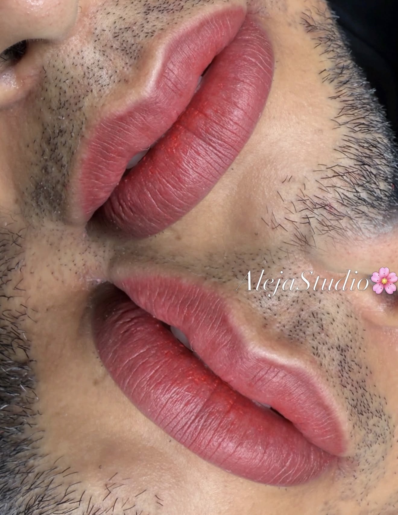 Neutralización de labios — Aleja Studio